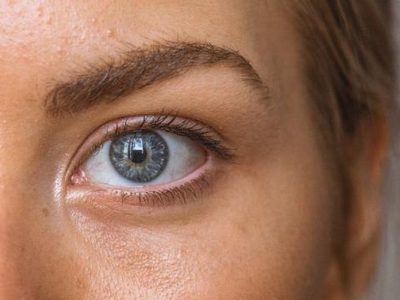 Pori Pori Wajah Membesar Akibat Kebiasaan Buruk Berikut Ini