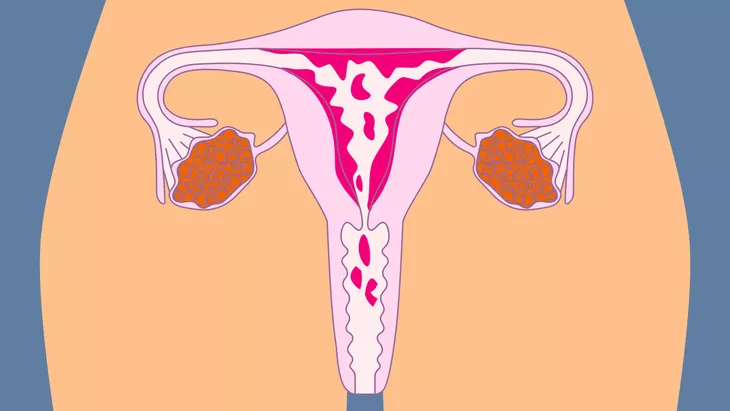 Sikap Unik Wanita Yang Sedang Mengalami Menstruasi