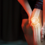 Osteoporosis Banyak Kita Temukan Pada Penderita Usia Lanjutan