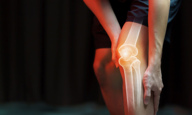 Osteoporosis Banyak Kita Temukan Pada Penderita Usia Lanjutan